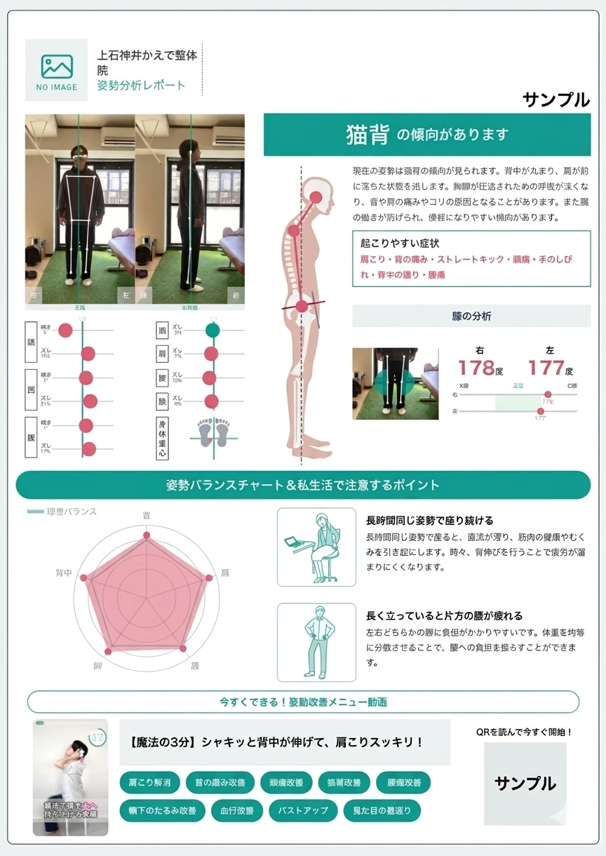 AI姿勢分析アプリで実際に表示される分析レポート画面のイメージ。骨盤・猫背・反り腰などが数値とグラフで可視化される。